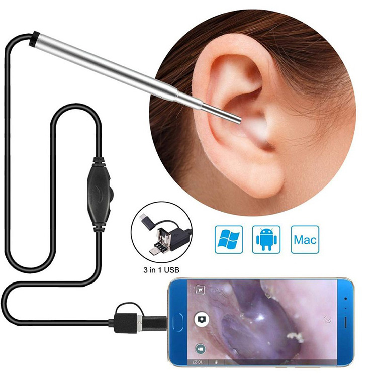 Medical Endoscope Kamara Kunnen Hanci Endoscope Usb Otoscope